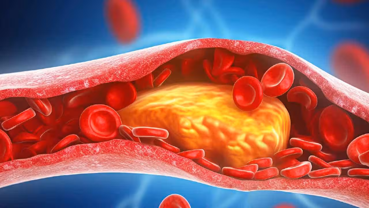 Foods To Reduce Cholesterol | కొలెస్ట్రాల్ స్థాయిలను తగ్గించే 5 ఆహారాలు.. స్పష్టం చేసిన వైద్య నిపుణులు..