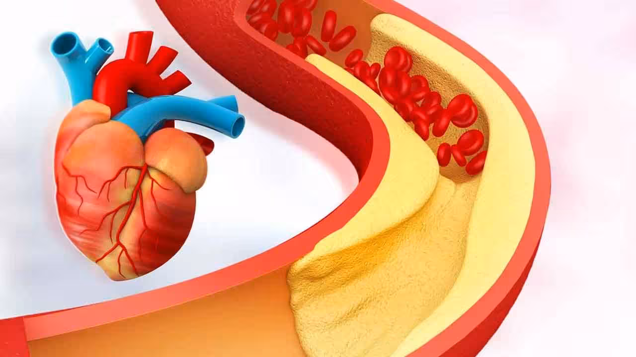 Foods To Reduce High Cholesterol | కొలెస్ట్రాల్ స్థాయిలు అధికంగా ఉన్నవారికి సూపర్ ఫుడ్స్ ఇవి.. రోజూ తినాలి..!