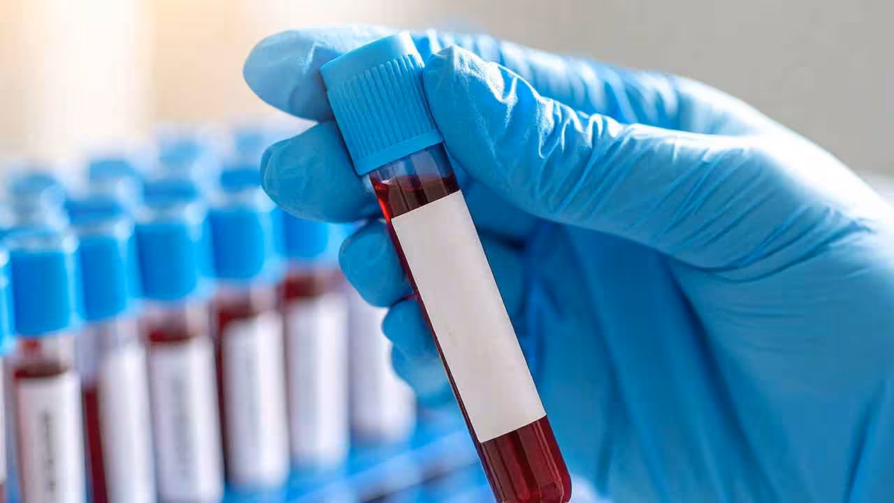 Medical Tests | 40 ఏళ్లు దాటిన పురుషులు కచ్చితంగా చేయించుకోవాల్సిన వైద్య పరీక్షలు ఇవే..!