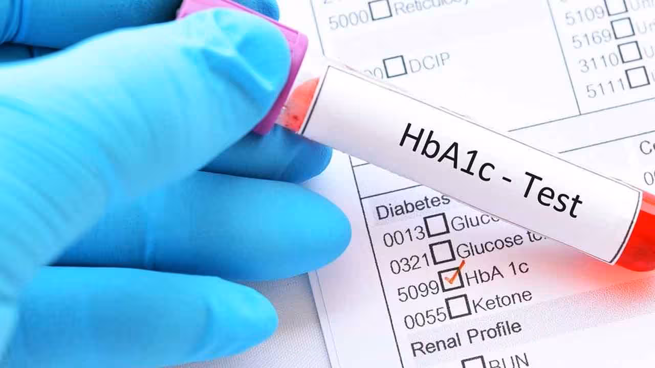 Diabetes | కేవలం HbA1c లెవల్స్నే చూస్తే నష్టమే.. డయాబెటిస్ చికిత్సపై లాన్సెట్ కీలక అధ్యయనం..