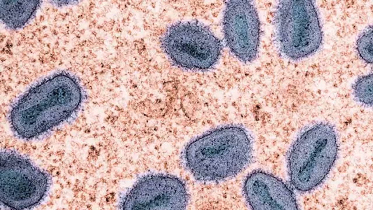 MPox Strain | భారత్, యూకేలలో ఎంపాక్స్ కొత్త స్ట్రెయిన్ కేసులు.. WHO హెచ్చరికలు..