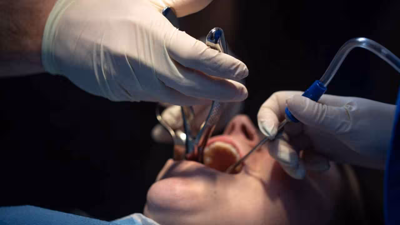 Tooth Extraction | వికటించిన వైద్యం.. దంతాన్ని తొలగించే క్రమంలో మహిళ మృతి.. డాక్టర్ పరారీ..