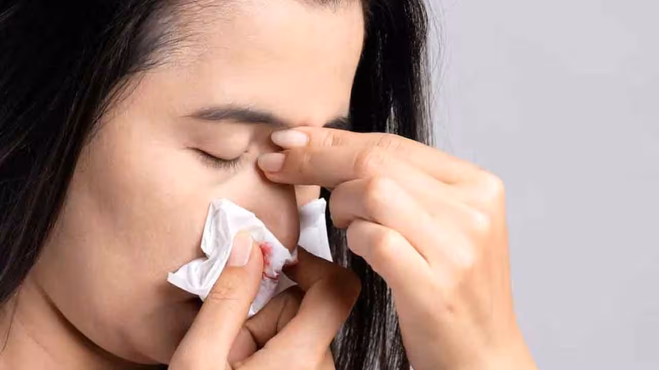 Nose Bleeding | వేసవిలో చాలా మందికి ఎదురయ్యే ముక్కు రక్తస్రావం సమస్య.. కారణాలేంటి..?